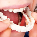 Carillas Dentales Snap On Smile (Incluye las 2)